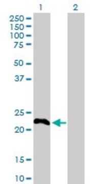 Anti-TSC22D3 antibody produced in rabbit purified immunoglobulin, buffered aqueous solution