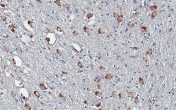 Anti-Prodynorphin (Dynorphin B29) Antibody, clone Dyn9 clone Dyn9, from mouse