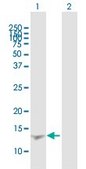 Anti-RETN antibody produced in mouse purified immunoglobulin, buffered aqueous solution