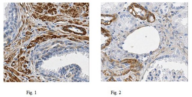 Anti-Filamin A Antibody, clone TI10, Ascites Free clone TI10, 1&#160;mg/mL, from mouse