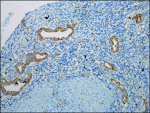 Anti-TRIM62 affinity isolated antibody