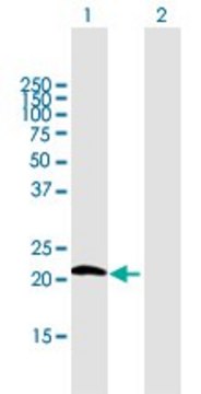 Anti-GPX7 antibody produced in mouse purified immunoglobulin, buffered aqueous solution