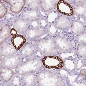Anti-AQP3 antibody produced in rabbit Prestige Antibodies&#174; Powered by Atlas Antibodies, affinity isolated antibody, buffered aqueous glycerol solution