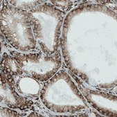 Monoclonal Anti-MTDH antibody produced in mouse Prestige Antibodies&#174; Powered by Atlas Antibodies, clone CL0397, purified immunoglobulin, buffered aqueous glycerol solution