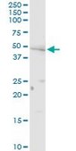 Anti-PNPLA3 antibody produced in rabbit purified immunoglobulin, buffered aqueous solution