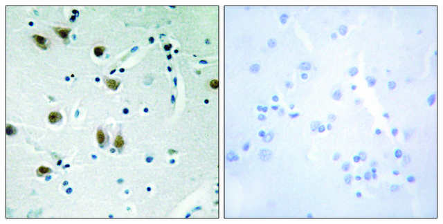Anti-ZNF148, N-Terminal antibody produced in rabbit affinity isolated antibody