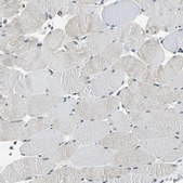 Anti-GATAD2A antibody produced in rabbit Prestige Antibodies&#174; Powered by Atlas Antibodies, affinity isolated antibody, buffered aqueous glycerol solution