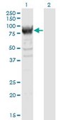Monoclonal Anti-RRM1 antibody produced in mouse clone 1D6, purified immunoglobulin, buffered aqueous solution