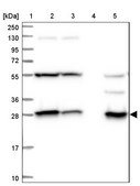 Anti-SPR antibody produced in rabbit Prestige Antibodies&#174; Powered by Atlas Antibodies, affinity isolated antibody, buffered aqueous glycerol solution