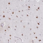 Anti-DPF1 antibody produced in rabbit Prestige Antibodies&#174; Powered by Atlas Antibodies, affinity isolated antibody, buffered aqueous glycerol solution