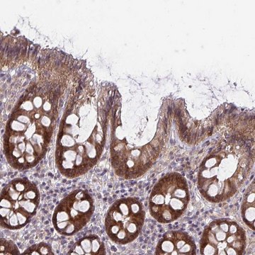 Anti-CASP9 antibody produced in rabbit Prestige Antibodies&#174; Powered by Atlas Antibodies, affinity isolated antibody, buffered aqueous glycerol solution