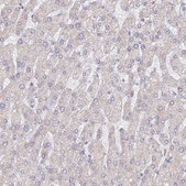 Anti-WDR62 antibody produced in rabbit Prestige Antibodies&#174; Powered by Atlas Antibodies, affinity isolated antibody, buffered aqueous glycerol solution
