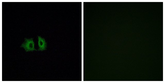 Anti-FZD5 antibody produced in rabbit affinity isolated antibody