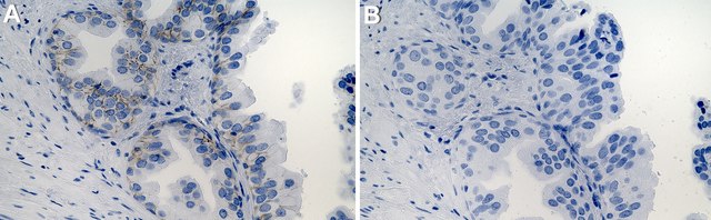 Anti-Syntaxin 4 Antibody, clone 1B9 ZooMAb&#174; Rabbit Monoclonal recombinant, expressed in HEK 293 cells