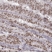 Monoclonal Anti-SNAI1 antibody produced in mouse Prestige Antibodies&#174; Powered by Atlas Antibodies, clone CL3700, purified immunoglobulin, buffered aqueous glycerol solution