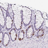 Anti-SLC18A1 antibody produced in rabbit Prestige Antibodies&#174; Powered by Atlas Antibodies, affinity isolated antibody