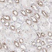 Anti-KCNJ1 antibody produced in rabbit Prestige Antibodies&#174; Powered by Atlas Antibodies, affinity isolated antibody, buffered aqueous glycerol solution