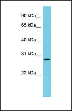 Anti-DNAJB9, (N-terminal) antibody produced in rabbit affinity isolated antibody