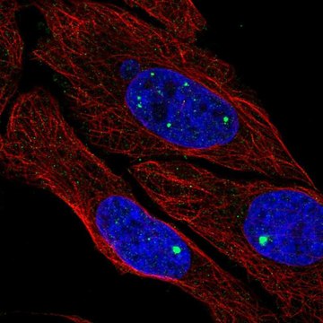 Anti-ZDHHC4 antibody produced in rabbit Prestige Antibodies&#174; Powered by Atlas Antibodies, affinity isolated antibody