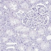 Anti-TNNT1 antibody produced in rabbit Prestige Antibodies&#174; Powered by Atlas Antibodies, affinity isolated antibody, buffered aqueous glycerol solution