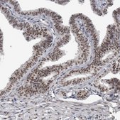 Anti-DDX42 antibody produced in rabbit affinity isolated antibody, buffered aqueous glycerol solution