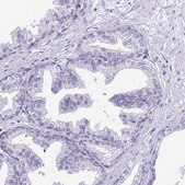 Anti-PRM2 antibody produced in rabbit Prestige Antibodies&#174; Powered by Atlas Antibodies, affinity isolated antibody, buffered aqueous glycerol solution