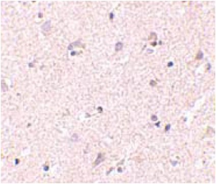 Anti-NANOS1 Antibody from rabbit, purified by affinity chromatography
