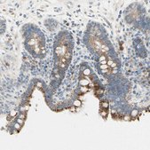 Anti-ALDH18A1 antibody produced in rabbit Prestige Antibodies&#174; Powered by Atlas Antibodies, affinity isolated antibody, buffered aqueous glycerol solution