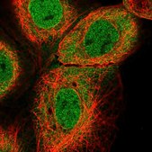 Anti-TRIM26 antibody produced in rabbit Prestige Antibodies&#174; Powered by Atlas Antibodies, affinity isolated antibody, buffered aqueous glycerol solution