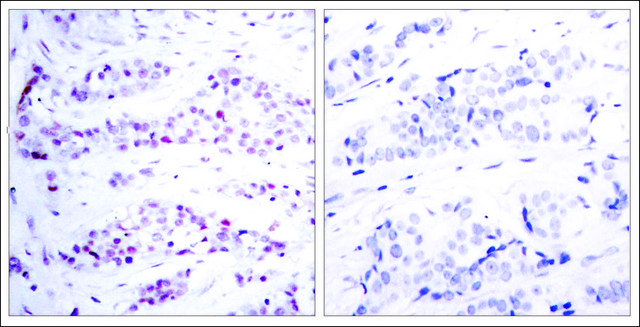 Anti-STAT6 (Ab-641) antibody produced in rabbit affinity isolated antibody