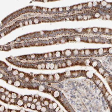 Anti-CHADL antibody produced in rabbit Prestige Antibodies&#174; Powered by Atlas Antibodies, affinity isolated antibody, buffered aqueous glycerol solution