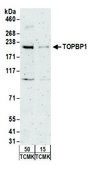 Rabbit anti-TopBP1 Antibody, Affinity Purified Powered by Bethyl Laboratories, Inc.