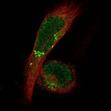 Monoclonal Anti-Adam10 Antibody Produced In Mouse Prestige Antibodies&#174; Powered by Atlas Antibodies, clone CL13815, affinity isolated antibody, buffered aqueous glycerol solution