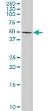Anti-RAD18 antibody produced in rabbit purified immunoglobulin, buffered aqueous solution
