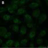 Anti-Notch1 Antibody, clone 1A32 ZooMAb&#174; Rabbit Monoclonal recombinant, expressed in HEK 293 cells