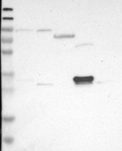 Anti-DDAH2 antibody produced in rabbit Prestige Antibodies&#174; Powered by Atlas Antibodies, affinity isolated antibody, buffered aqueous glycerol solution