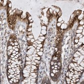 Anti-MXI1 antibody produced in rabbit Prestige Antibodies&#174; Powered by Atlas Antibodies, affinity isolated antibody, buffered aqueous glycerol solution