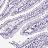 Anti-FABP3 antibody produced in rabbit Prestige Antibodies&#174; Powered by Atlas Antibodies, affinity isolated antibody, buffered aqueous glycerol solution