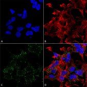 Monoclonal Anti-Copper Transporting Atpase 2 - Atto 390 antibody produced in mouse clone S62-29, purified immunoglobulin