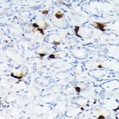 Anti-Somatostatin (SST) Antibody, clone 7Q4T0, Rabbit Monoclonal