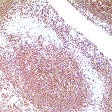 CD20 (L26) Mouse Monoclonal Antibody