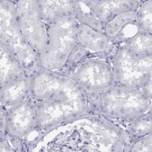 Anti-LOR Prestige Antibodies&#174; Powered by Atlas Antibodies, affinity isolated antibody