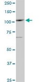 Monoclonal Anti-SALL4 antibody produced in mouse clone 6E3, purified immunoglobulin, buffered aqueous solution