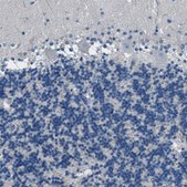 Anti-FBN1 antibody produced in rabbit Prestige Antibodies&#174; Powered by Atlas Antibodies, affinity isolated antibody, buffered aqueous glycerol solution