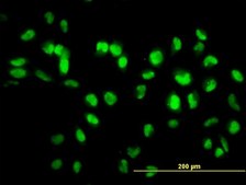 Monoclonal Anti-SIRT1 antibody produced in mouse clone 7B7, purified immunoglobulin, buffered aqueous solution