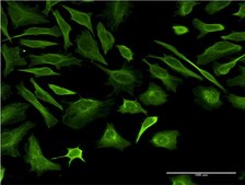 Monoclonal Anti-TUBB2A antibody produced in mouse clone 2B2, purified immunoglobulin, buffered aqueous solution
