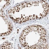 Anti-ZMYM2 antibody produced in rabbit Prestige Antibodies&#174; Powered by Atlas Antibodies, affinity isolated antibody, buffered aqueous glycerol solution