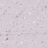 Anti-KIFC1 antibody produced in rabbit Prestige Antibodies&#174; Powered by Atlas Antibodies, affinity isolated antibody, buffered aqueous glycerol solution