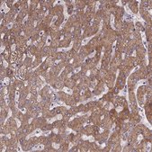 Anti-PAH antibody produced in rabbit Prestige Antibodies&#174; Powered by Atlas Antibodies, affinity isolated antibody, buffered aqueous glycerol solution