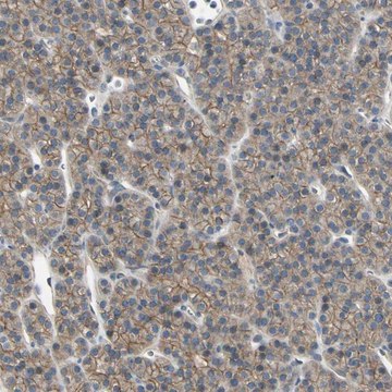 Anti-RNF180 antibody produced in rabbit Prestige Antibodies&#174; Powered by Atlas Antibodies, affinity isolated antibody, buffered aqueous glycerol solution